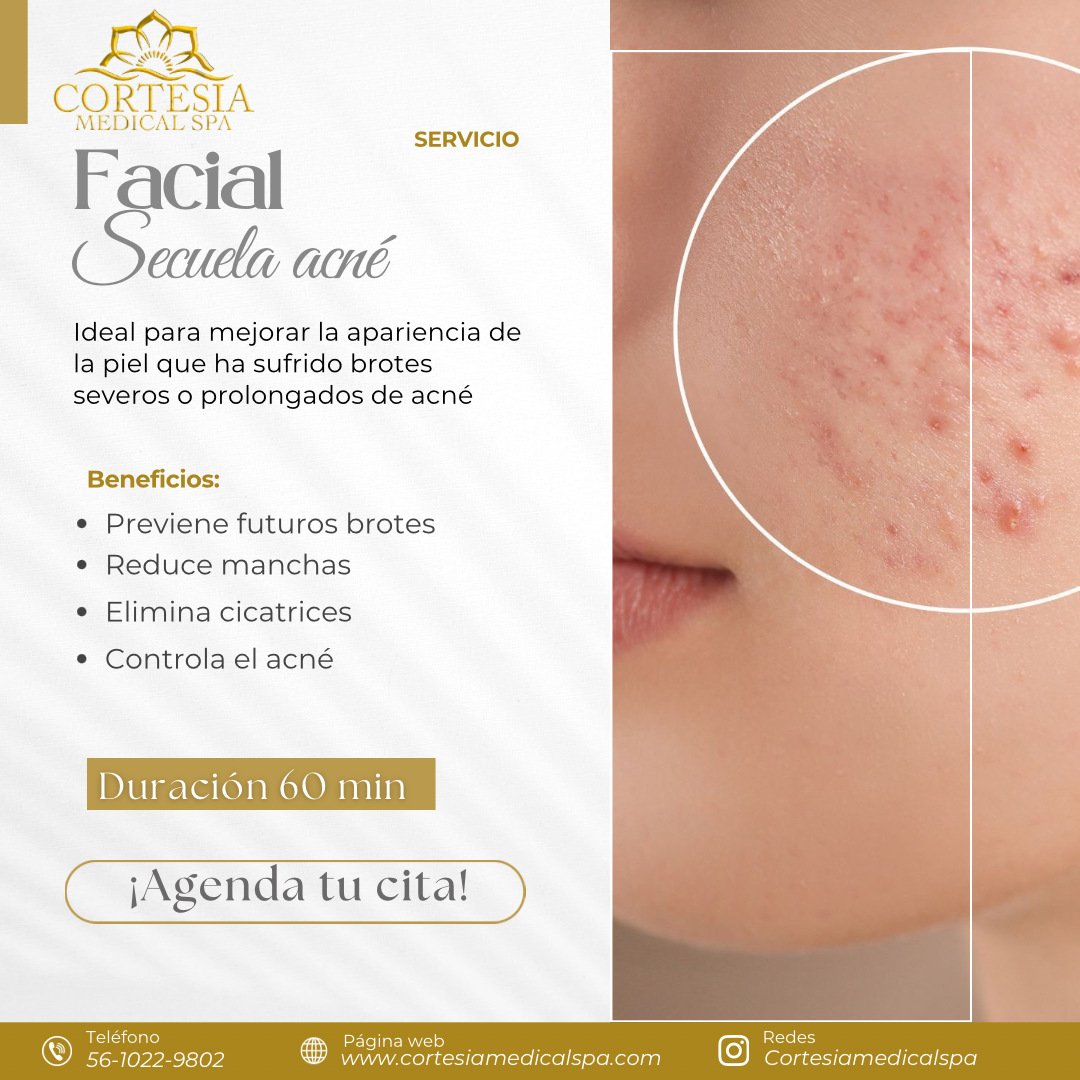 Facial Secuela Acné